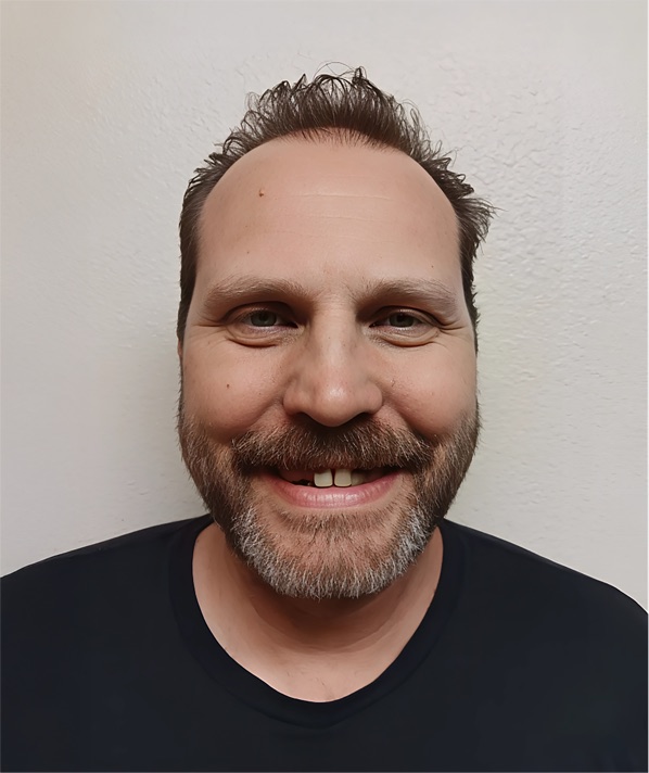 AJ B. before treatment at Aspen Dental